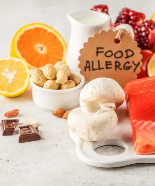 Food Allergy Training Course